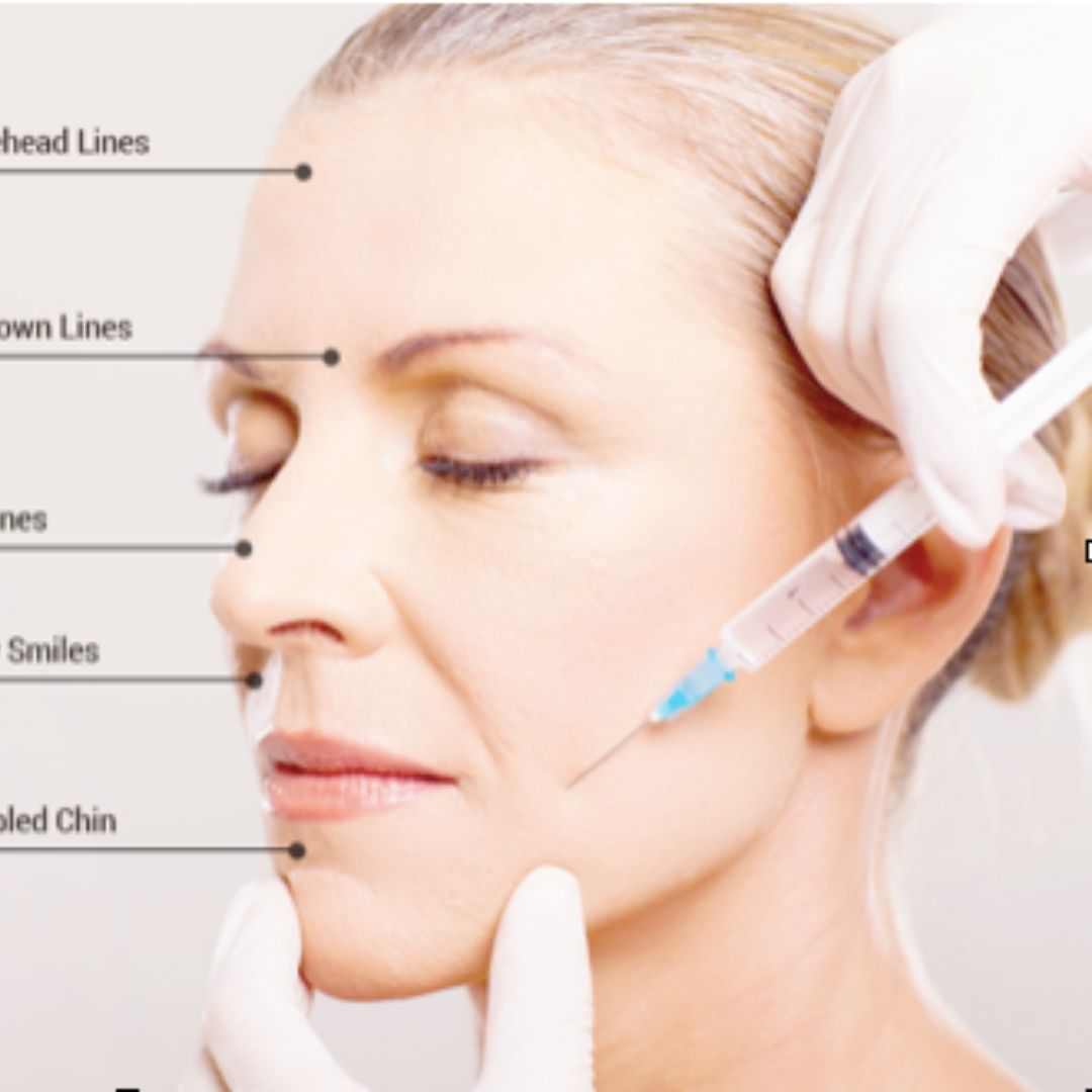 Botox for Wrinkles, Skin and Beauty Care Treatment