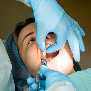Your Guide to Understanding Wisdom Teeth Removal