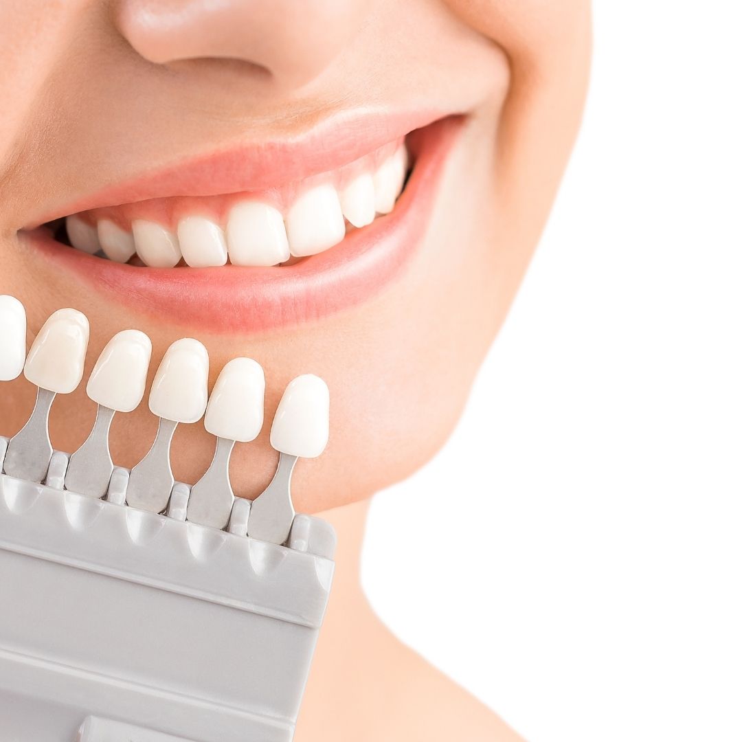 What Are Major Restorative Dental Procedures LIFESTYLE BY PS
