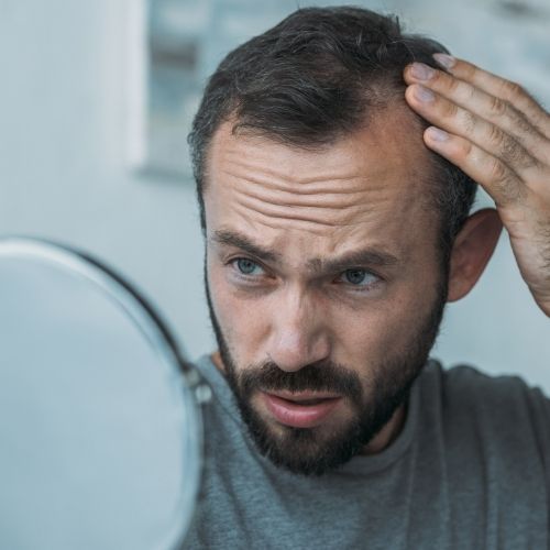 A Man's Guide to the Top Causes of Hair Loss