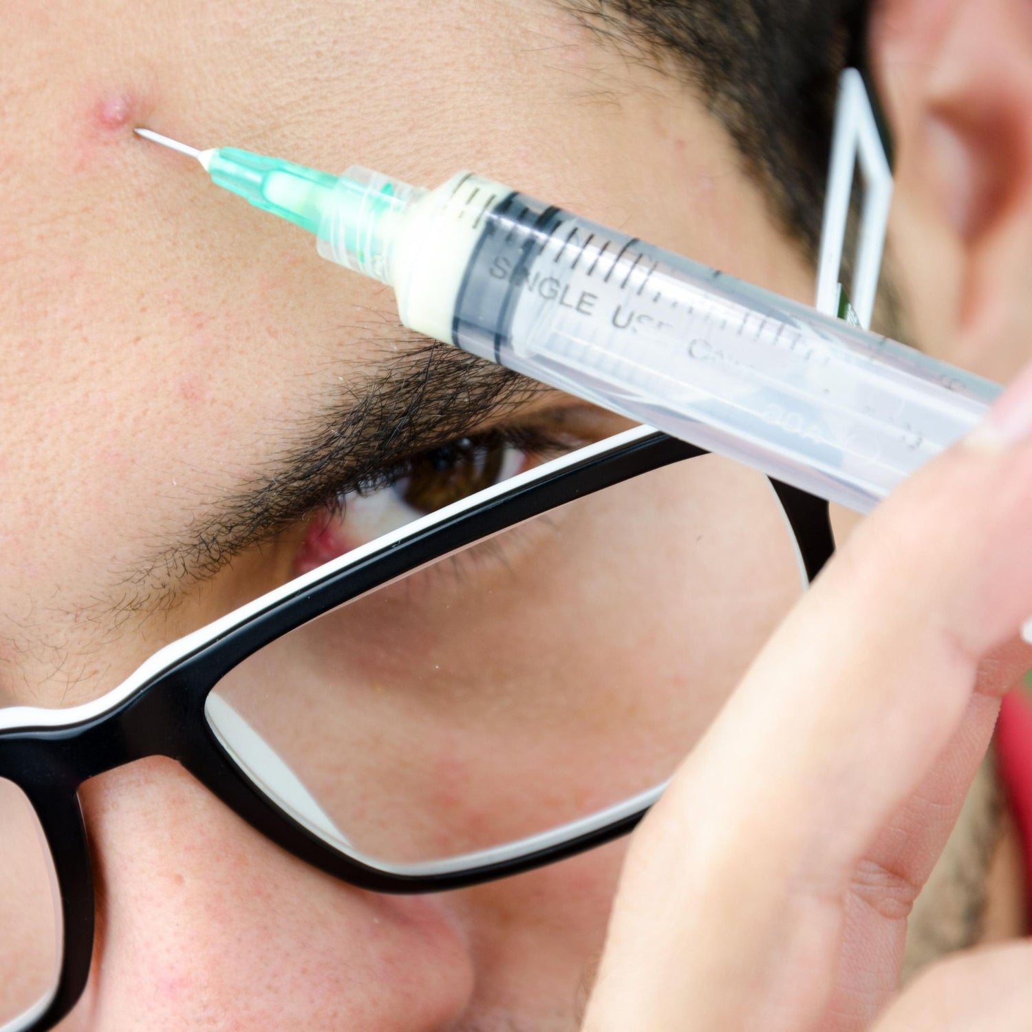 Botox Treatment for Men