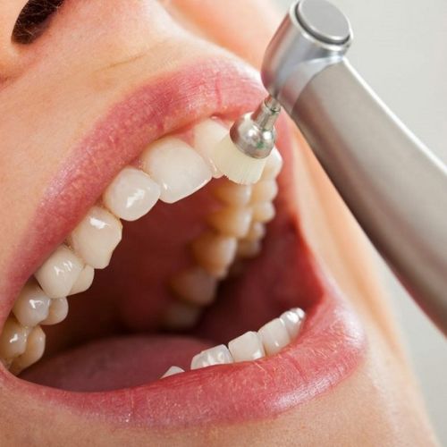 What Should I Expect When Going for a Dental Cleaning?