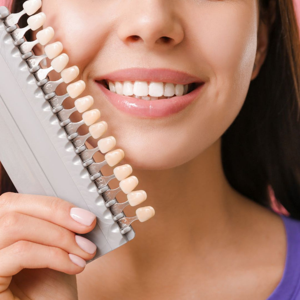 The Art of Smile: Unveiling the Aesthetic Value of Dental Veneers