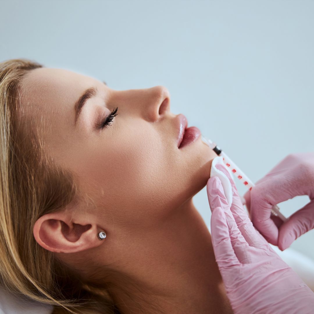 Dermal Fillers at Medical Spa RX: Your Path to Achieving Smooth, Radiant Skin