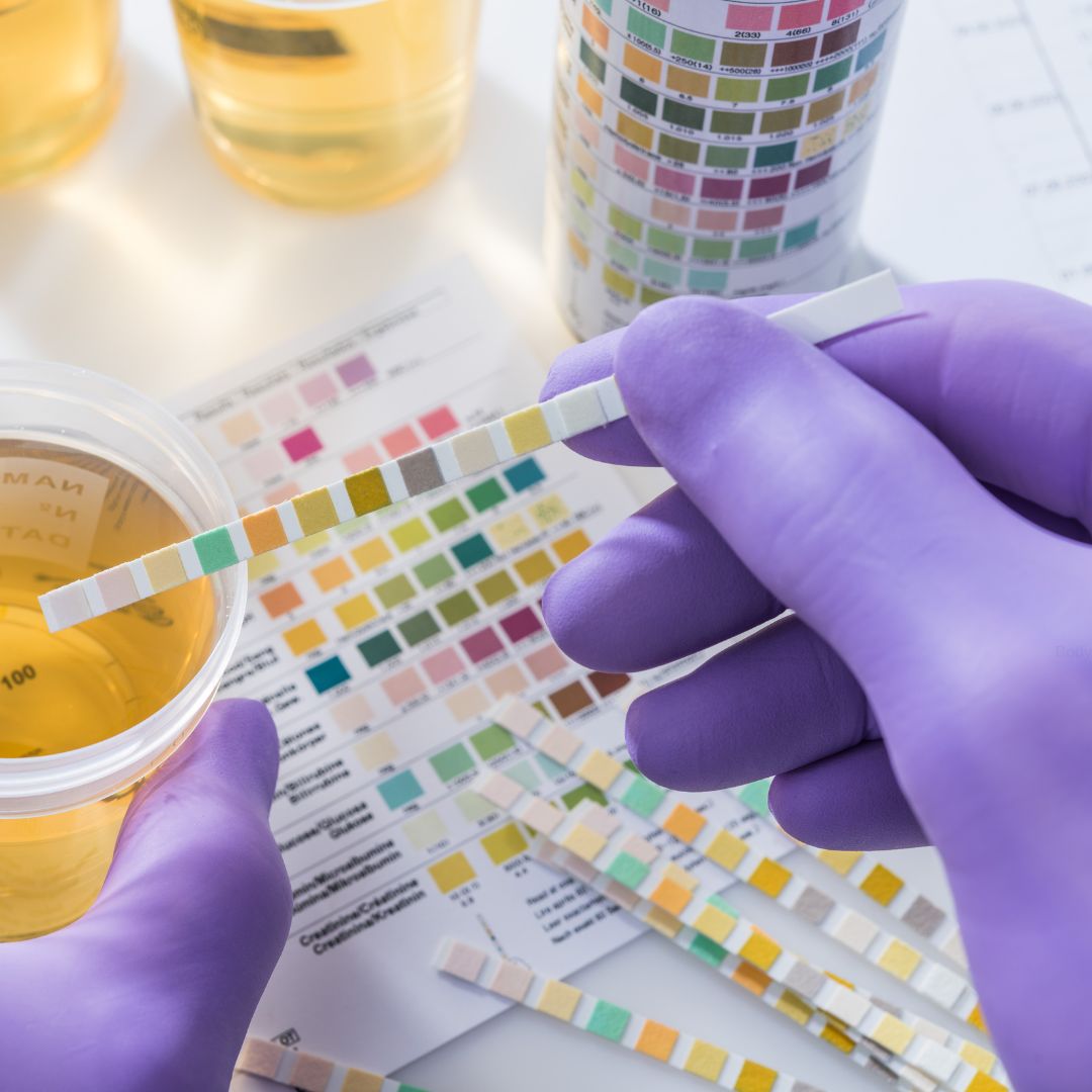Drug Testing
