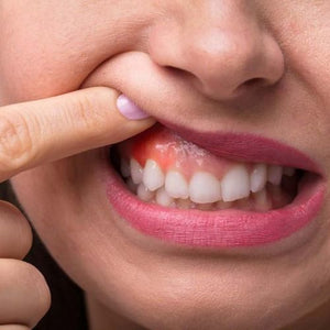 A Beginner's Guide to Gum Disease
