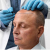 Hair Transplant Medical Science Explained
