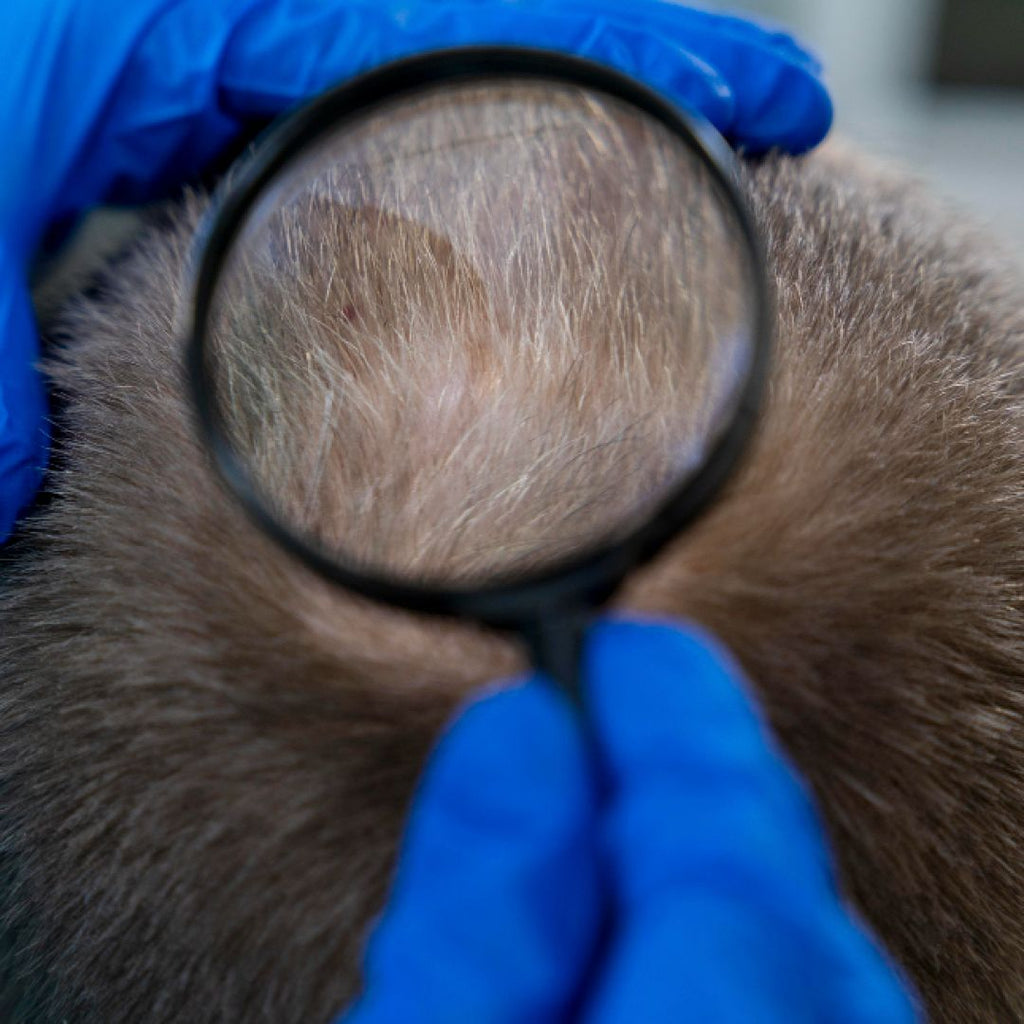 Hair Transplants