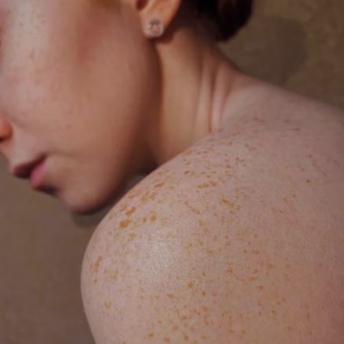 Have Healthier-Looking Skin with These Skincare Secrets