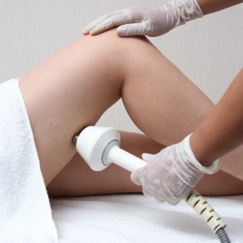 Laser cellulite reduction