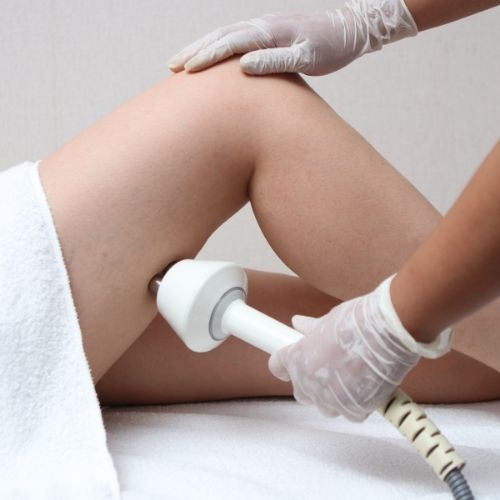 Laser cellulite reduction