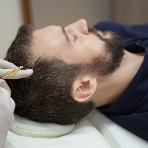 A Game-Changing Natural Solution for Men's Hair Loss Treatment through Advanced Hair System
