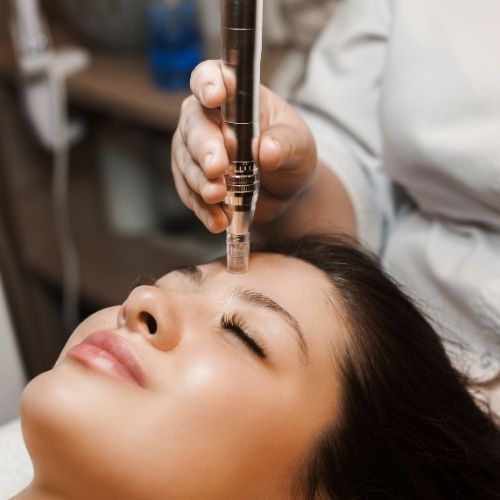 Top 3 Cases where Microneedling Is a Better Option than Nano Needling