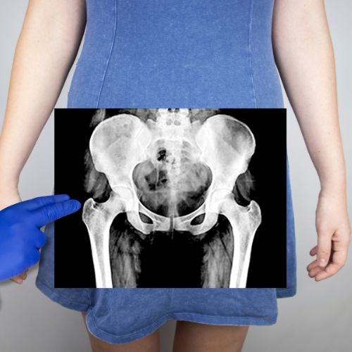 Where to Find Pediatric Pelvic Floor Physical Therapy