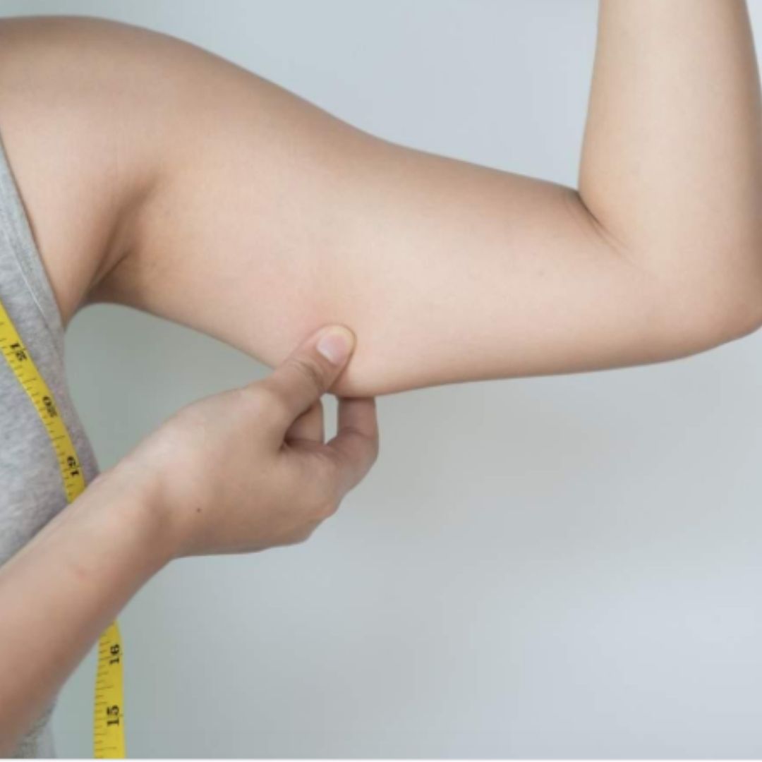 Is Coolsculpting A Potent Solution For Flabby Arms?