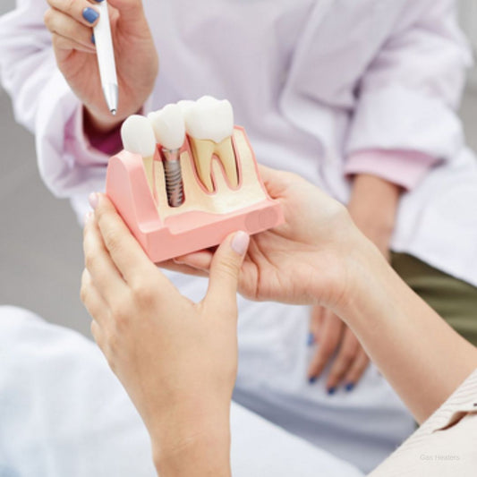 Dental Bridge vs. Implant