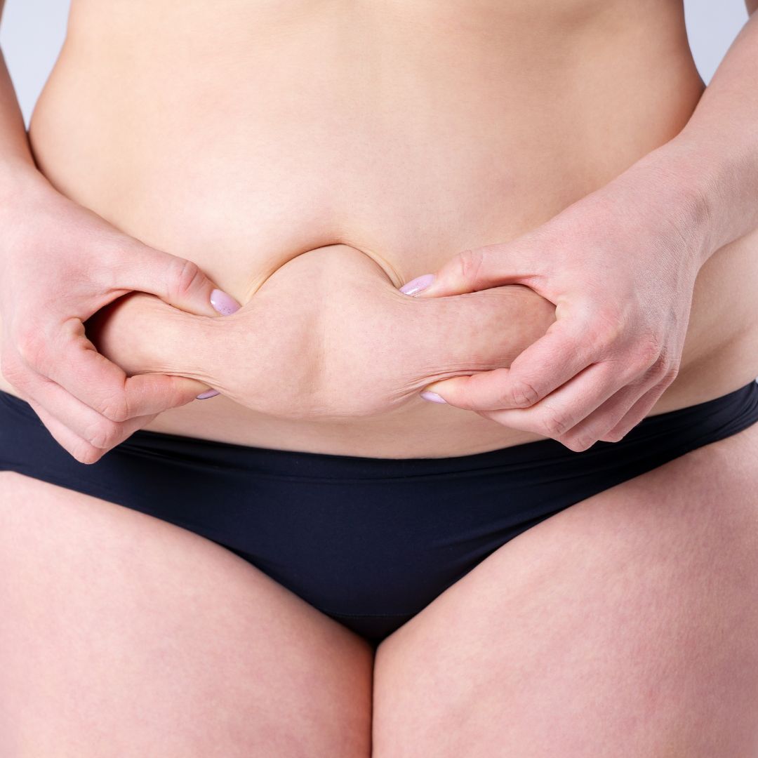 What Should I Wear After A Tummy Tuck Surgery?