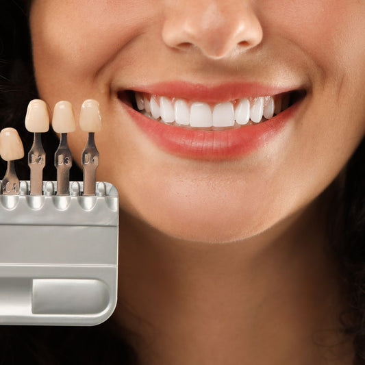 Veneers