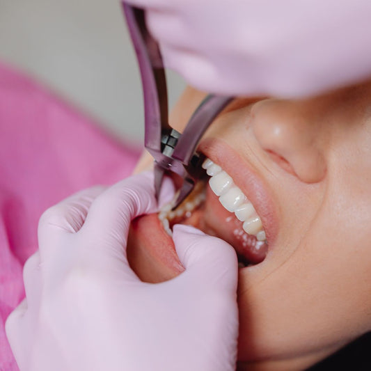 Wisdom Teeth Removal