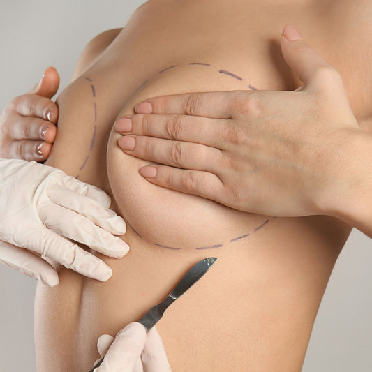 breast reduction surgery