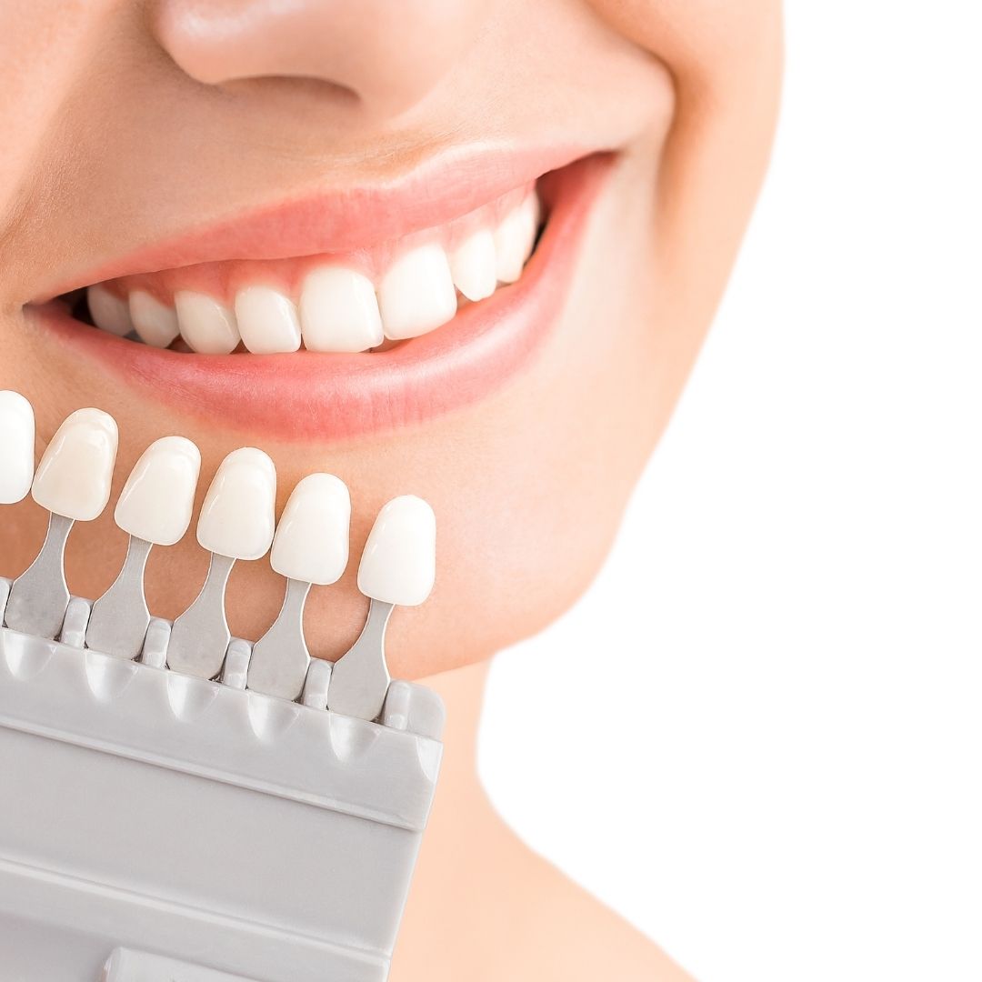 What Are Major Restorative Dental Procedures