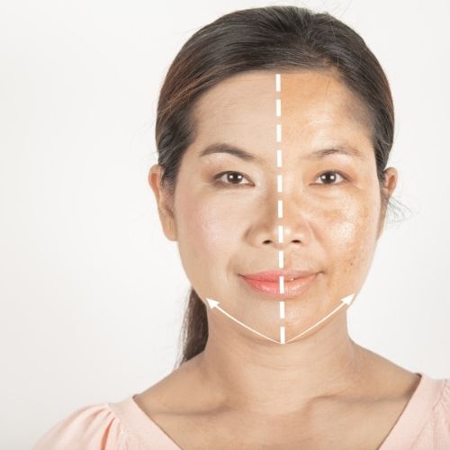 Facial Dark Spot Remover & Other Ways to Tackle the Issue
